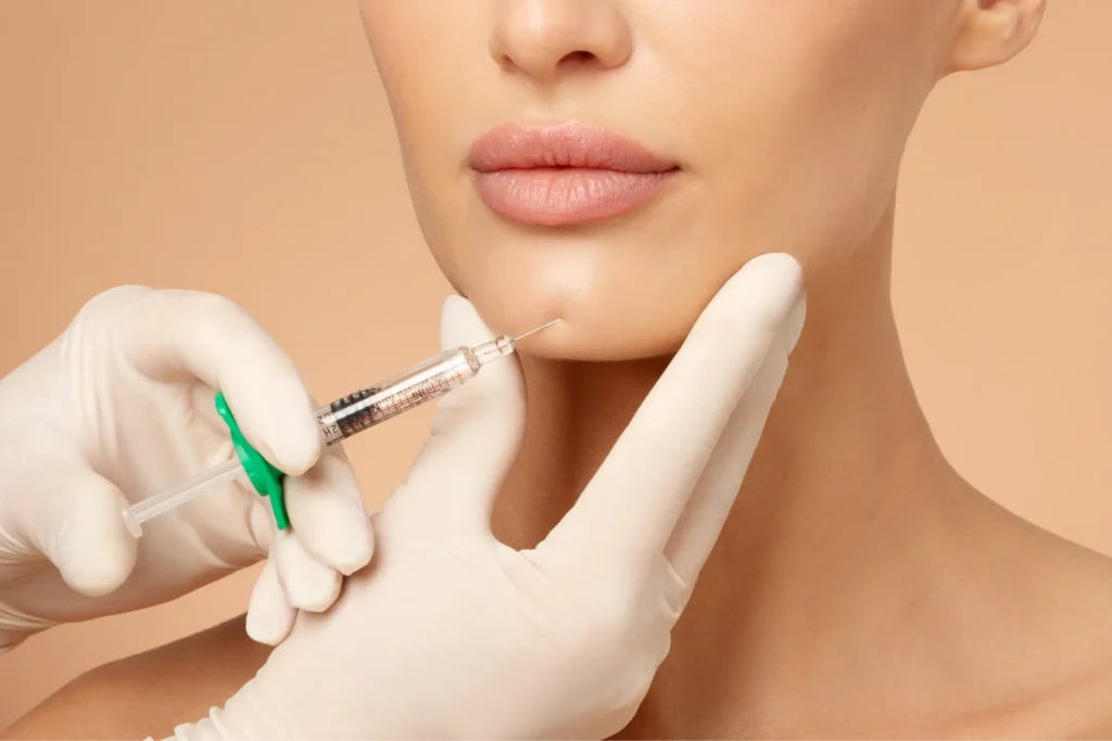 Chin filler treatment results in Palm Springs and Orange County, CA at Enve California Aesthetics
