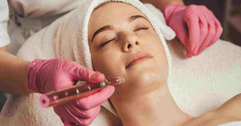 A person with their eyes closed is lying down with a white towel wrapped around their head. receiving a RF microneedling in Palm Springs, CA