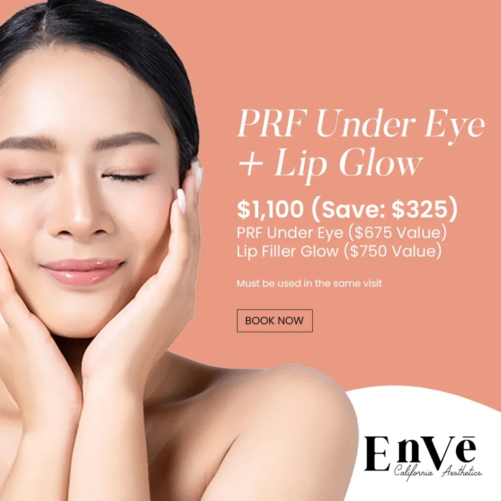 PRF under-eye treatment promotion highlighting rejuvenation and dark circle reduction offers in Palm Springs.