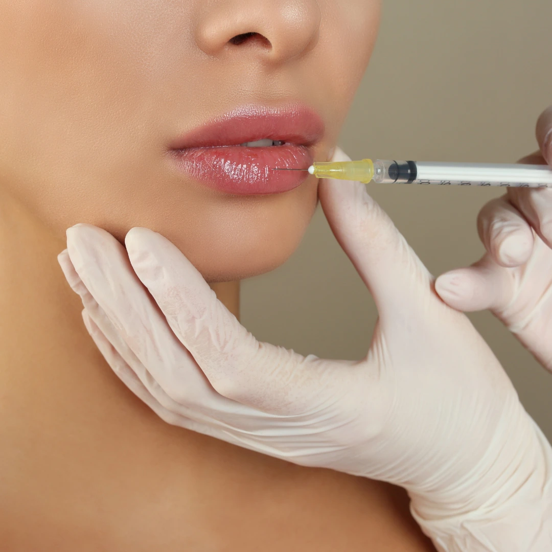 Dermal Fillers in Palm Springs & Orange County CA