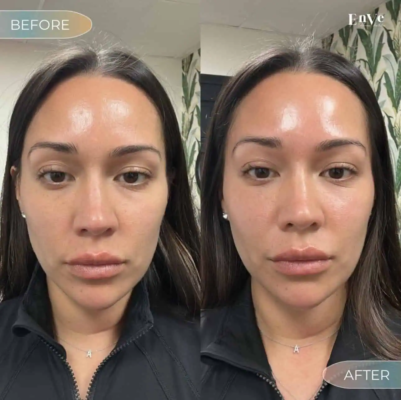 female patient at Enve California Aesthetics in Palm Springs, CA – smoother, youthful skin appearance.
