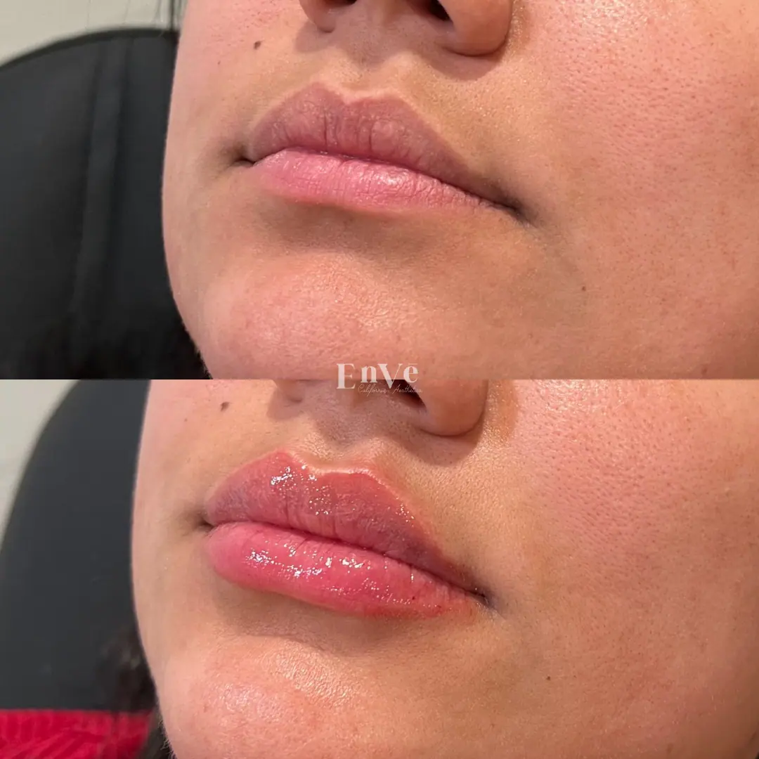 enhanced skin tone and facial contour after advanced skincare treatment at Enve California Aesthetics.