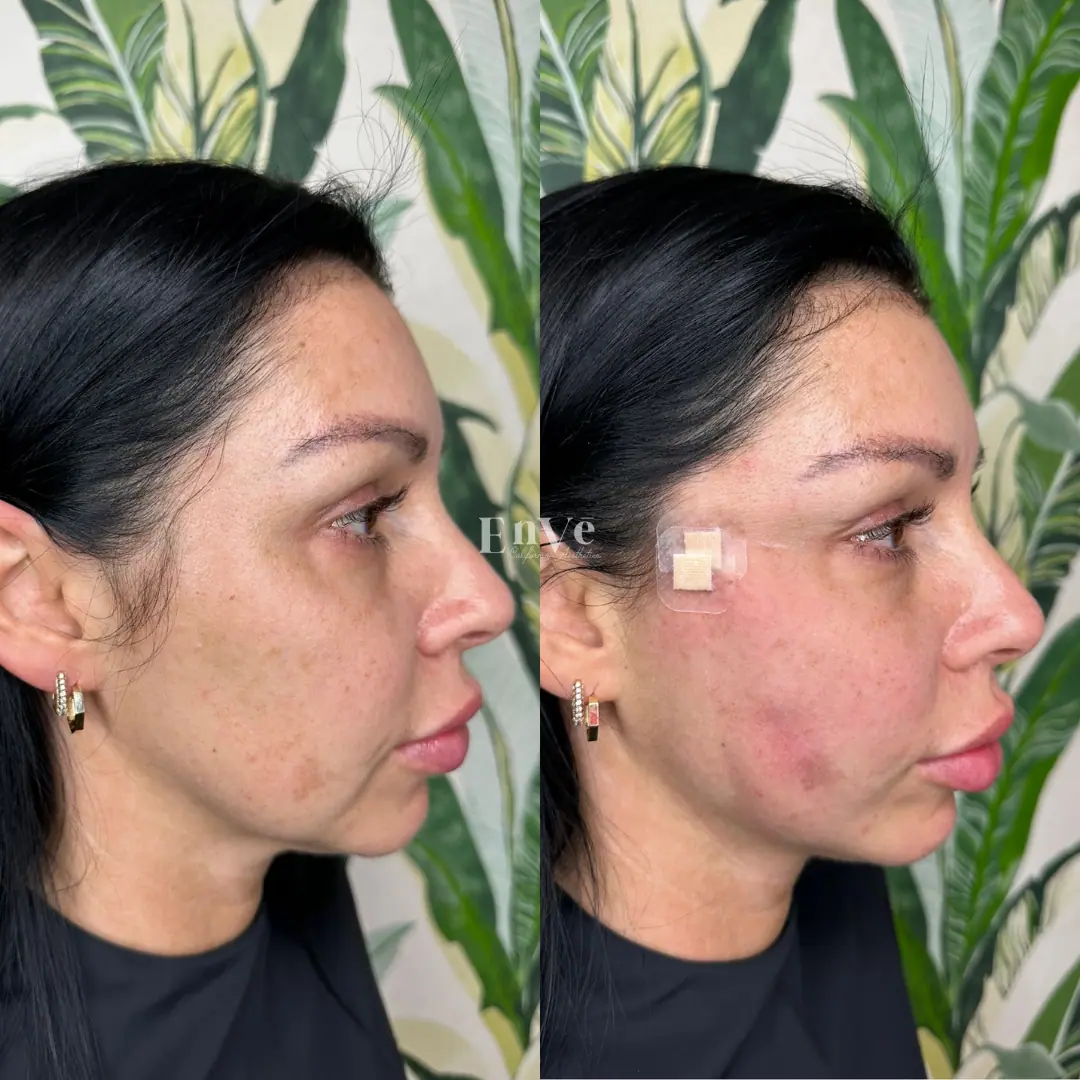 Woman after aesthetic treatment at Enve California Aesthetics in Palm Springs, CA – showcasing improved skin texture and youthful definition.