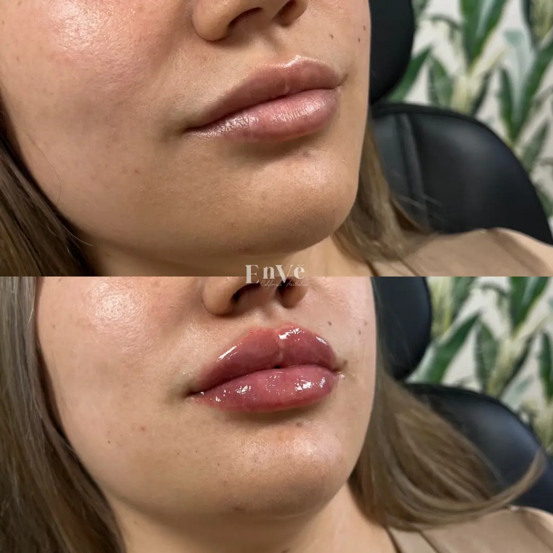 acial skin before and after cosmetic treatment, highlighting smoother texture and enhanced skin tone at Enve California Aesthetics.