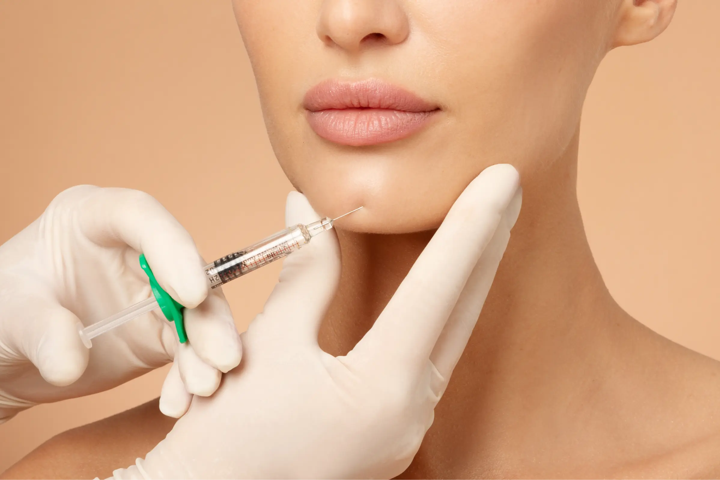 Chin filler treatment results in Palm Springs and Orange County, CA at Enve California Aesthetics