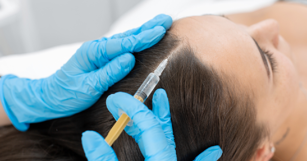 Woman receiving PRP treatment at MyEnve clinic in Palm Springs, Orange County, CA