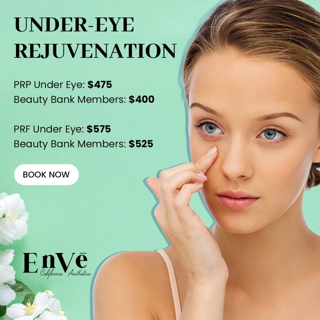Under-eye rejuvenation: PRP for $475 and PRF for $575 at Enve California Aesthetics.